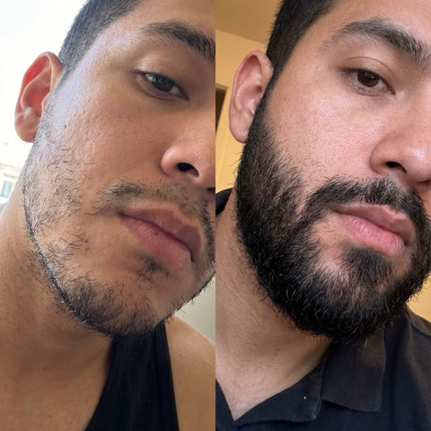 Bálsamo para barba con Minoxidil 20% Apolo