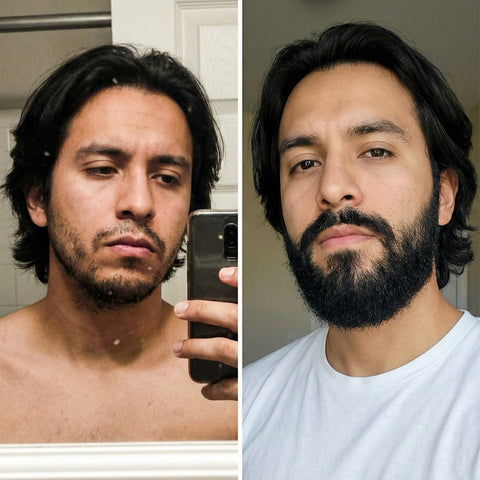 Bálsamo para barba con Minoxidil 20% Apolo